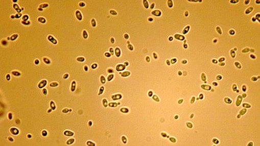 obraz za: http://www.medical-labs.net/wp-content/uploads/2015/03/Candida-glabrata-yeasts.jpg